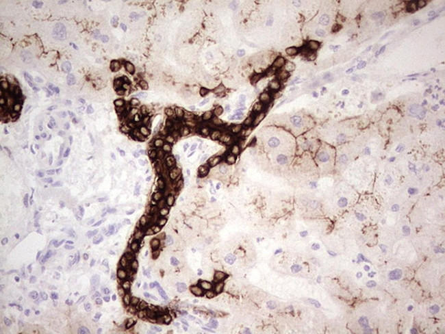 ABCB1 Antibody in Immunohistochemistry (Paraffin) (IHC (P))