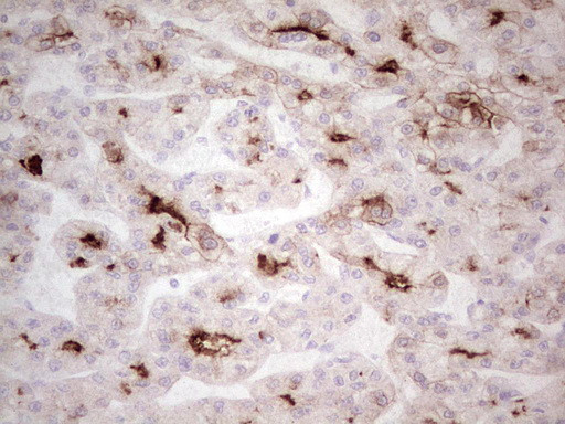 ABCB1 Antibody in Immunohistochemistry (Paraffin) (IHC (P))