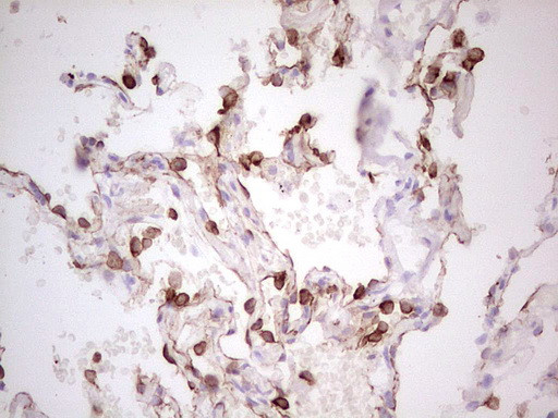 ABCB1 Antibody in Immunohistochemistry (Paraffin) (IHC (P))