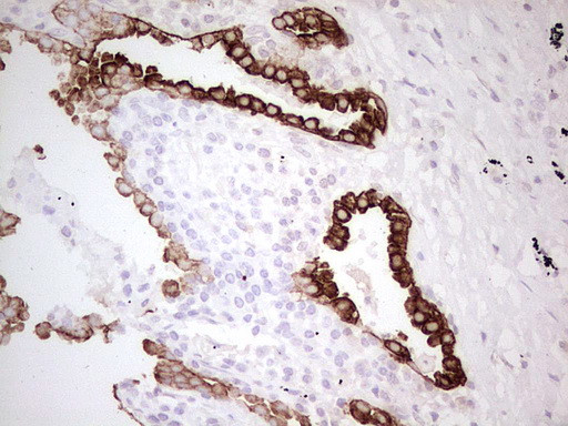 ABCB1 Antibody in Immunohistochemistry (Paraffin) (IHC (P))