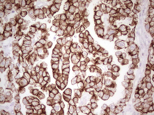 ABCB1 Antibody in Immunohistochemistry (Paraffin) (IHC (P))