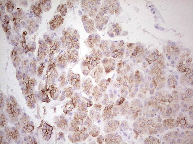 ABCB1 Antibody in Immunohistochemistry (Paraffin) (IHC (P))