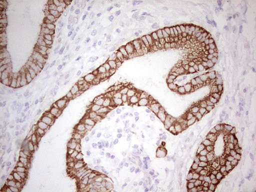 ABCB1 Antibody in Immunohistochemistry (Paraffin) (IHC (P))