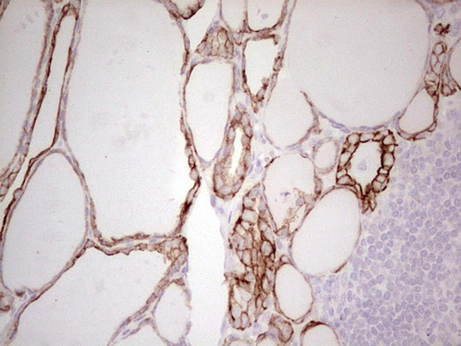 ABCB1 Antibody in Immunohistochemistry (Paraffin) (IHC (P))