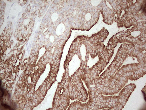 ABCB1 Antibody in Immunohistochemistry (Paraffin) (IHC (P))