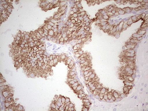 ABCB1 Antibody in Immunohistochemistry (Paraffin) (IHC (P))