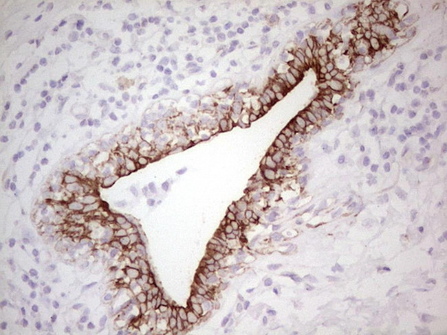 ABCB1 Antibody in Immunohistochemistry (Paraffin) (IHC (P))