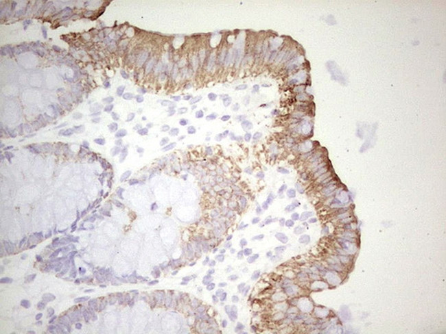 ABCB1 Antibody in Immunohistochemistry (Paraffin) (IHC (P))