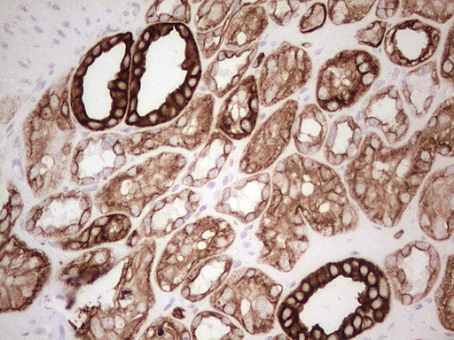 ABCB1 Antibody in Immunohistochemistry (Paraffin) (IHC (P))