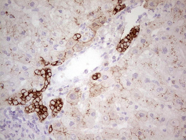 ABCB1 Antibody in Immunohistochemistry (Paraffin) (IHC (P))