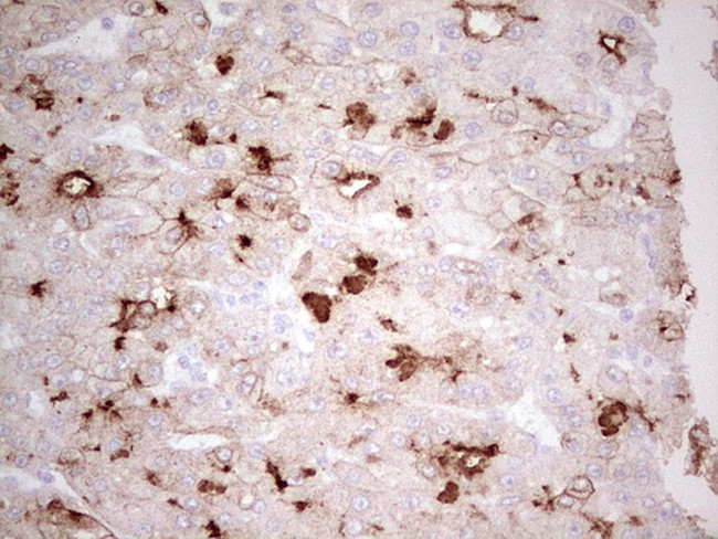 ABCB1 Antibody in Immunohistochemistry (Paraffin) (IHC (P))