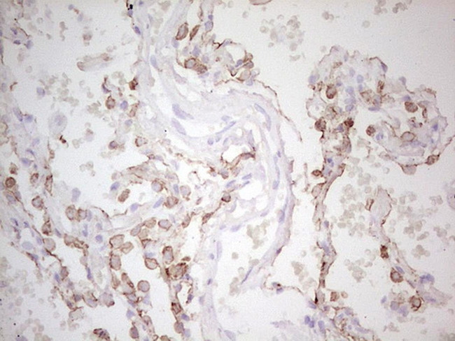 ABCB1 Antibody in Immunohistochemistry (Paraffin) (IHC (P))