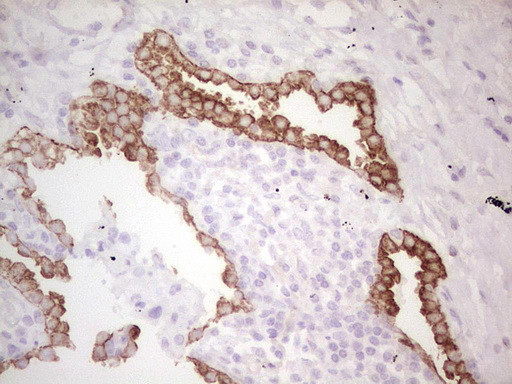 ABCB1 Antibody in Immunohistochemistry (Paraffin) (IHC (P))