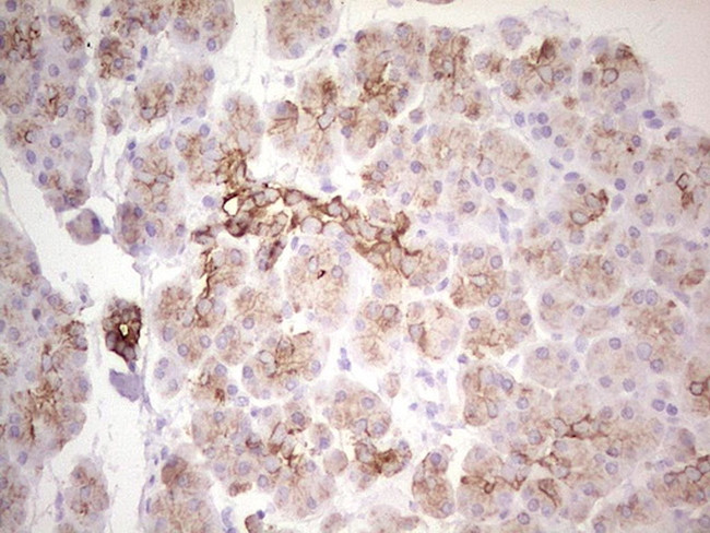 ABCB1 Antibody in Immunohistochemistry (Paraffin) (IHC (P))