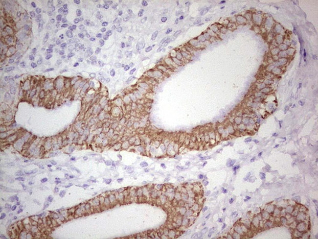 ABCB1 Antibody in Immunohistochemistry (Paraffin) (IHC (P))