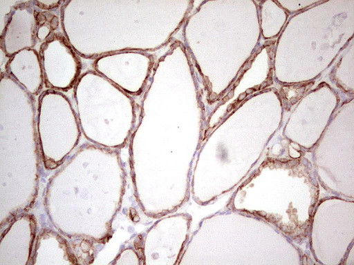 ABCB1 Antibody in Immunohistochemistry (Paraffin) (IHC (P))