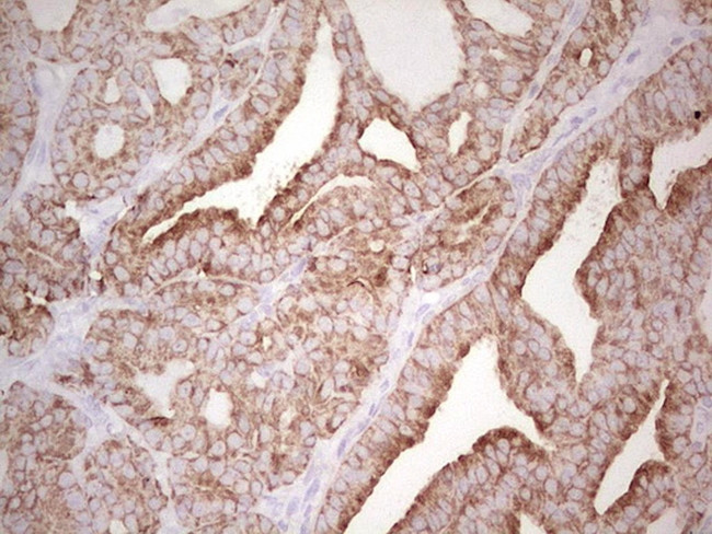 ABCB1 Antibody in Immunohistochemistry (Paraffin) (IHC (P))