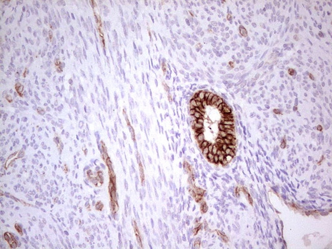 ABCB1 Antibody in Immunohistochemistry (Paraffin) (IHC (P))