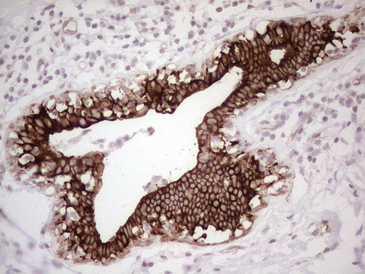 ABCB1 Antibody in Immunohistochemistry (Paraffin) (IHC (P))