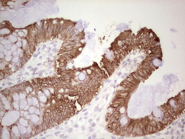 ABCB1 Antibody in Immunohistochemistry (Paraffin) (IHC (P))