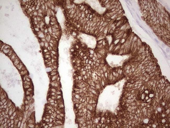 ABCB1 Antibody in Immunohistochemistry (Paraffin) (IHC (P))