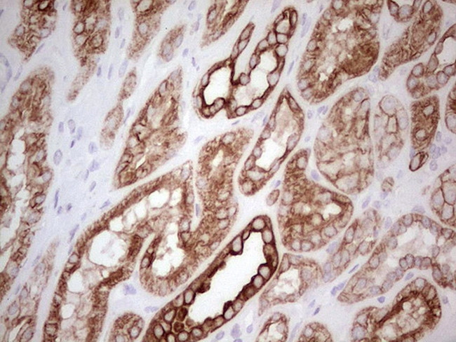 ABCB1 Antibody in Immunohistochemistry (Paraffin) (IHC (P))