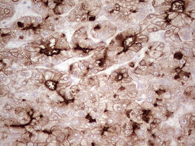 ABCB1 Antibody in Immunohistochemistry (Paraffin) (IHC (P))