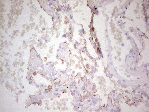 ABCB1 Antibody in Immunohistochemistry (Paraffin) (IHC (P))