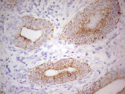 ABCB1 Antibody in Immunohistochemistry (Paraffin) (IHC (P))