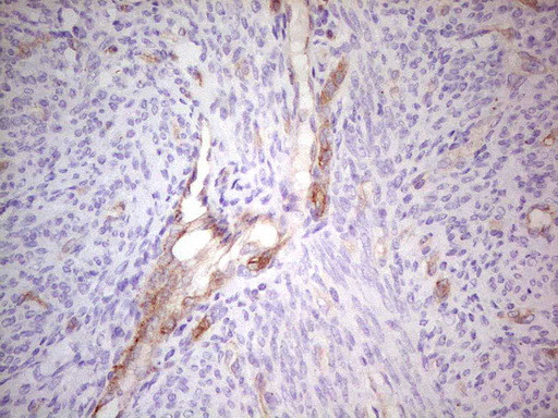 ABCB1 Antibody in Immunohistochemistry (Paraffin) (IHC (P))