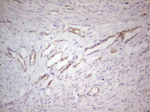 ABCB1 Antibody in Immunohistochemistry (Paraffin) (IHC (P))