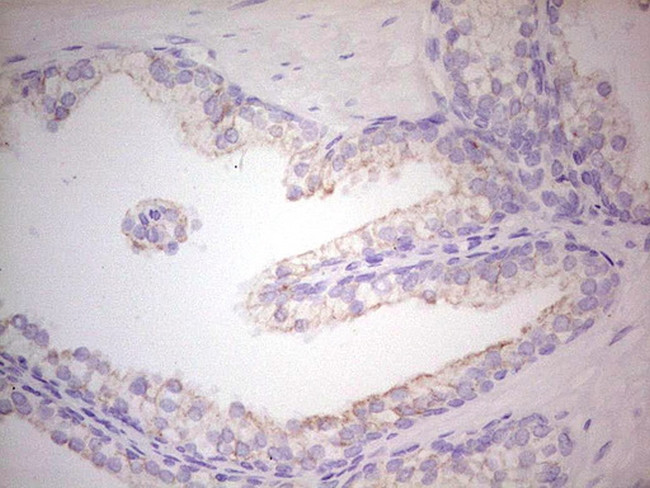 ABCB1 Antibody in Immunohistochemistry (Paraffin) (IHC (P))