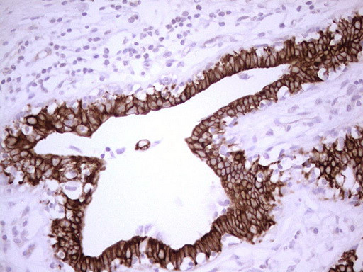 ABCB1 Antibody in Immunohistochemistry (Paraffin) (IHC (P))