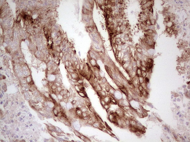 ABCB1 Antibody in Immunohistochemistry (Paraffin) (IHC (P))