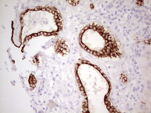 ABCB1 Antibody in Immunohistochemistry (Paraffin) (IHC (P))