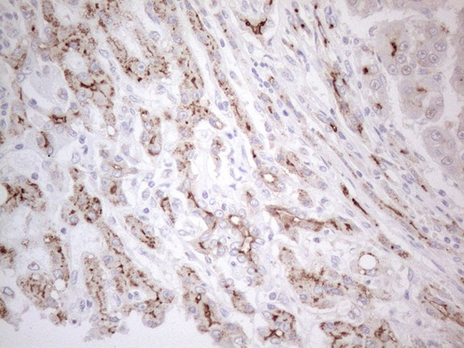 ABCB1 Antibody in Immunohistochemistry (Paraffin) (IHC (P))