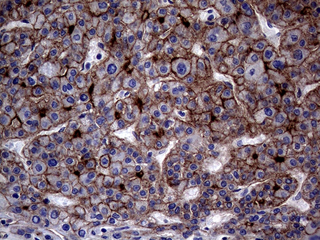 ABCB1 Antibody in Immunohistochemistry (Paraffin) (IHC (P))