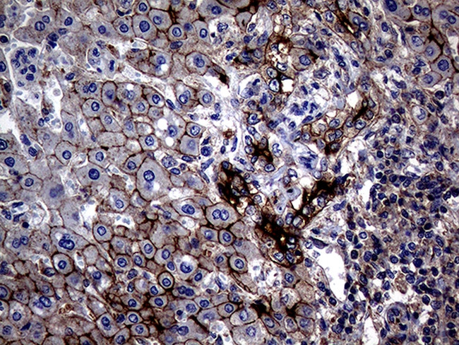 ABCB1 Antibody in Immunohistochemistry (Paraffin) (IHC (P))