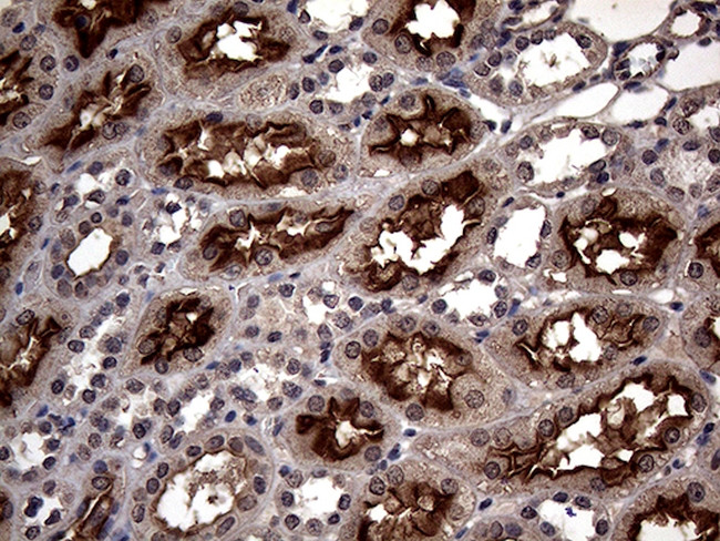 ABCB1 Antibody in Immunohistochemistry (Paraffin) (IHC (P))