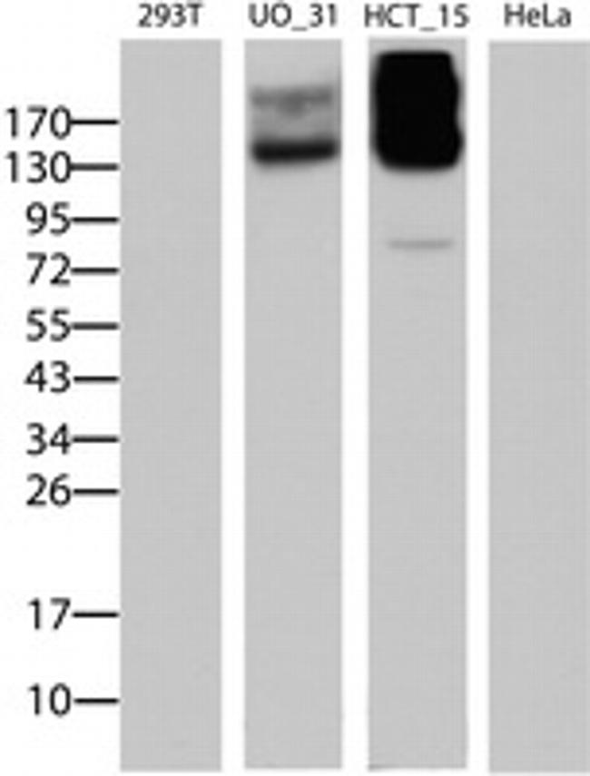 ABCB1 Antibody in Western Blot (WB)