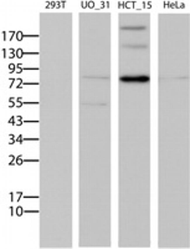 ABCB1 Antibody in Western Blot (WB)