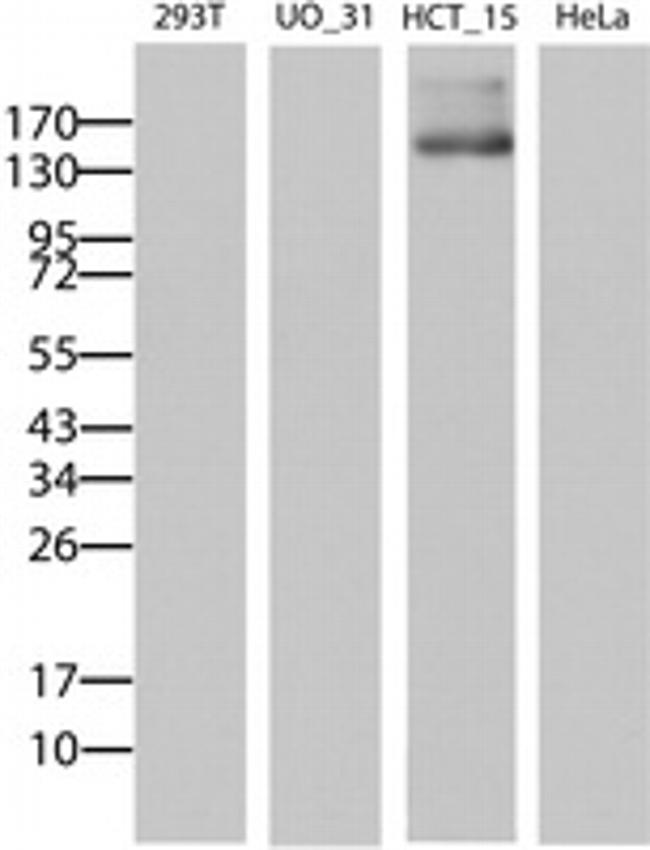 ABCB1 Antibody in Western Blot (WB)