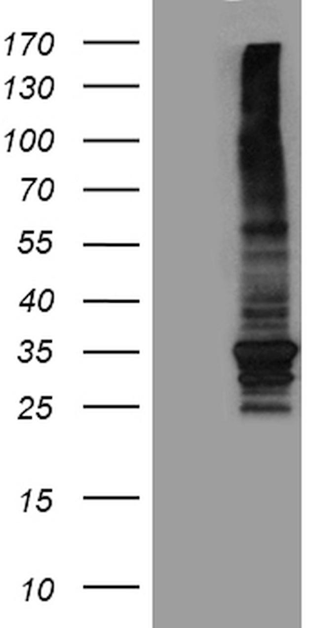 ABCB1 Antibody in Western Blot (WB)