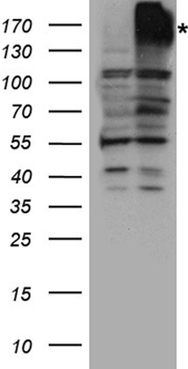 ABCB1 Antibody in Western Blot (WB)