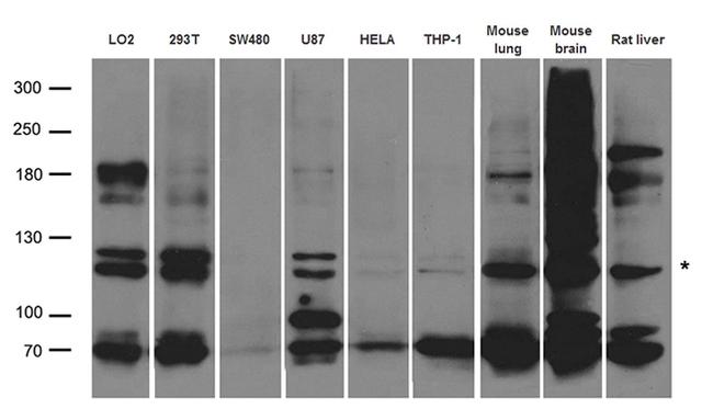 ABCB1 Antibody in Western Blot (WB)