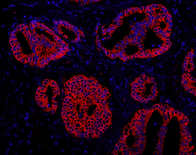 ABCB9 Antibody in Immunohistochemistry (IHC)