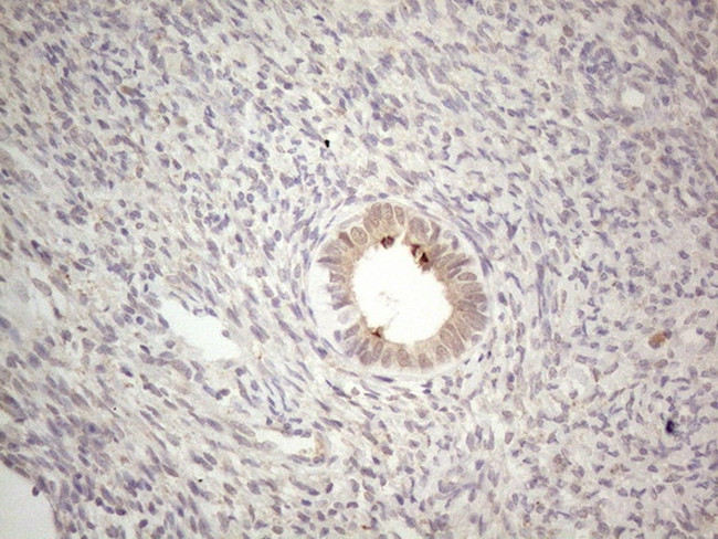 ABCC5 Antibody in Immunohistochemistry (Paraffin) (IHC (P))