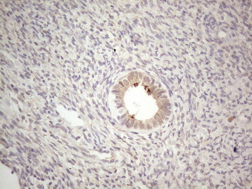 ABCC5 Antibody in Immunohistochemistry (Paraffin) (IHC (P))