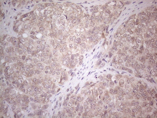 ABCC5 Antibody in Immunohistochemistry (Paraffin) (IHC (P))