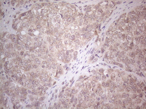 ABCC5 Antibody in Immunohistochemistry (Paraffin) (IHC (P))